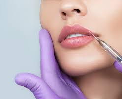 Lip Filler treatment Aberdeen