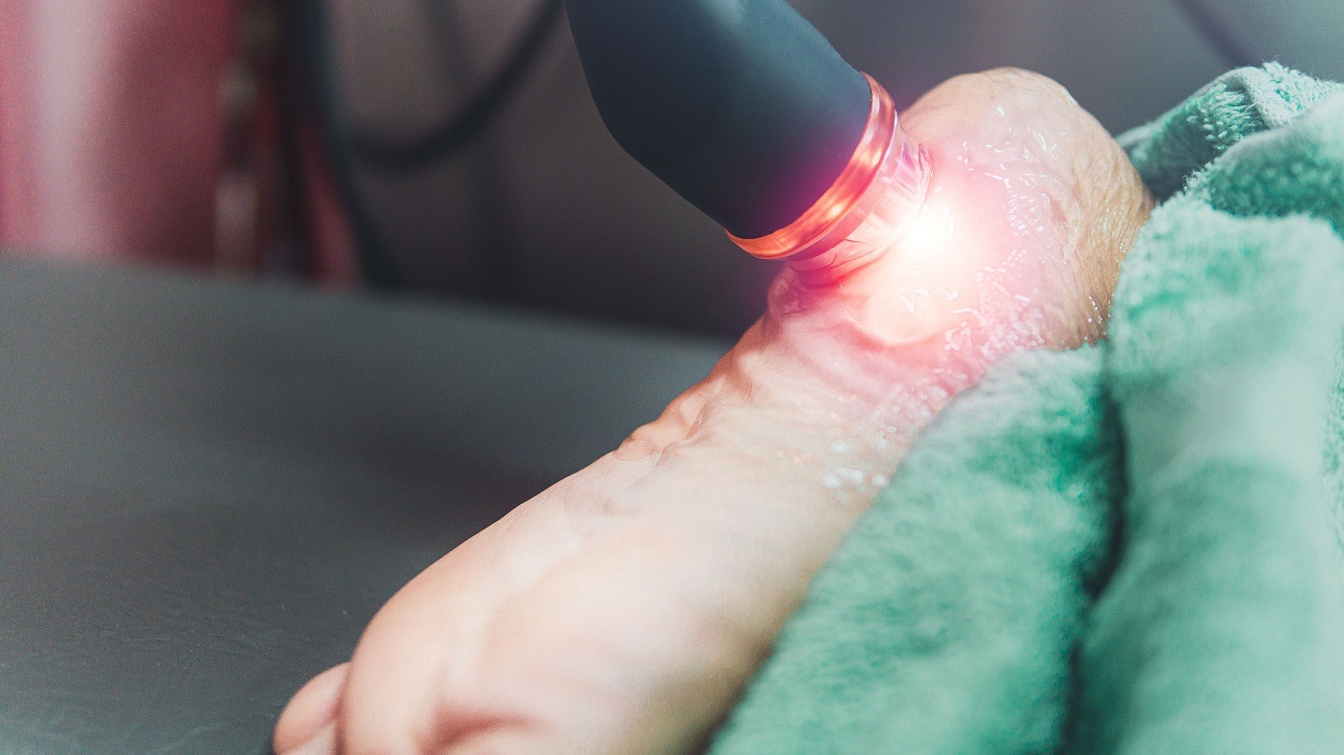 laser for plantar fasciitis