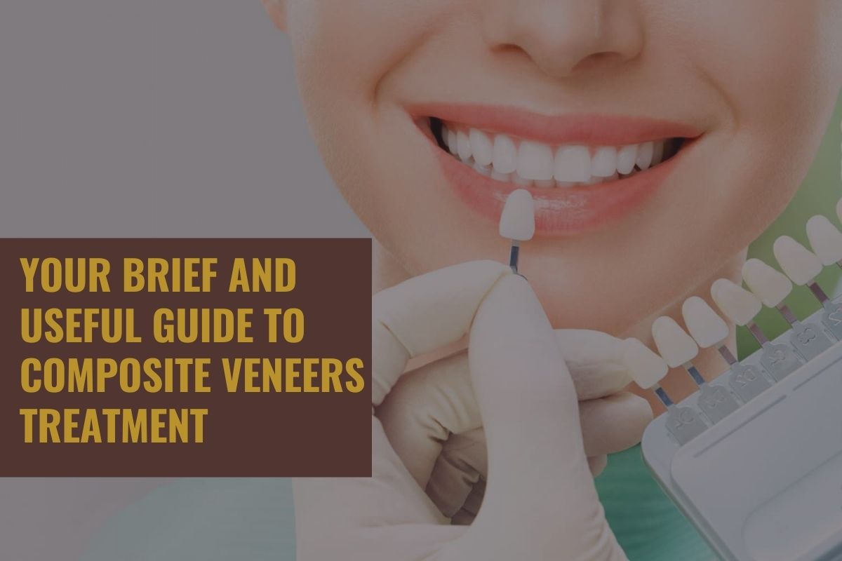 Your brief and useful guide to composite veneers treatment