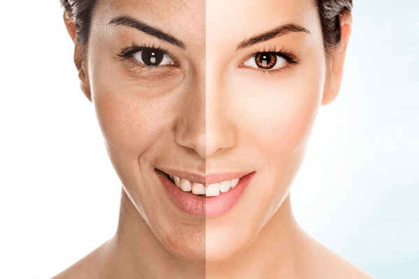 skin whitening treatment Ahmedabad