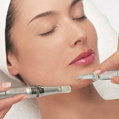 Microneedling Marvel: How Dermapen Can Transform Your Skin